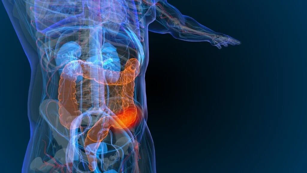 WVCI t Treating Colorectal Cancer and Other GI Cancers
