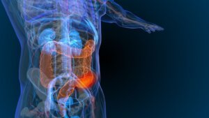 WVCI t Treating Colorectal Cancer and Other GI Cancers