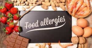 Food Allergies